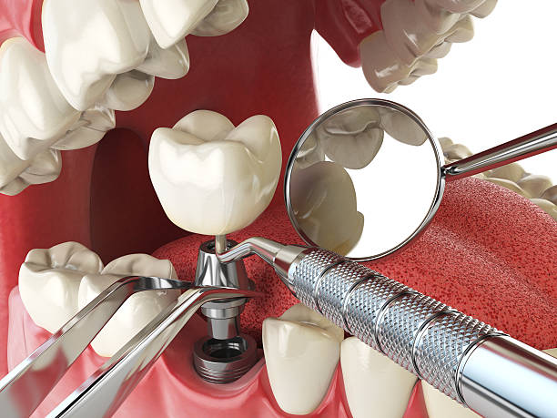 Best Emergency Pediatric Dental Care in Champaign, IL